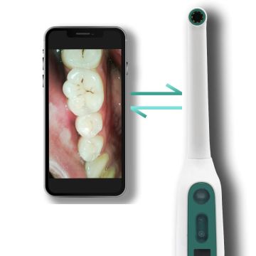 Oravall Live Dental Camera provjera zubnog kamenca 360 stupnjeva