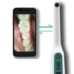 Oravall Live Dental Camera provjera zubnog kamenca 360 stupnjeva